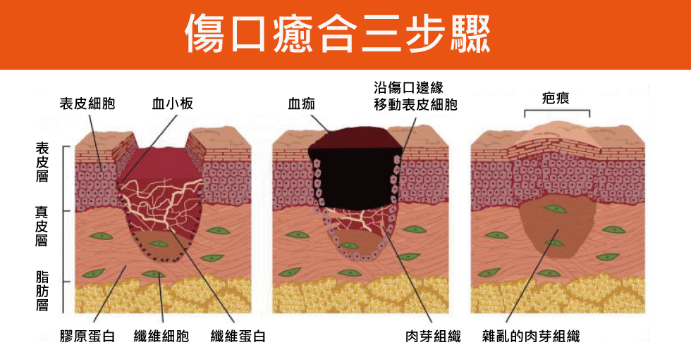 傷口癒合時間