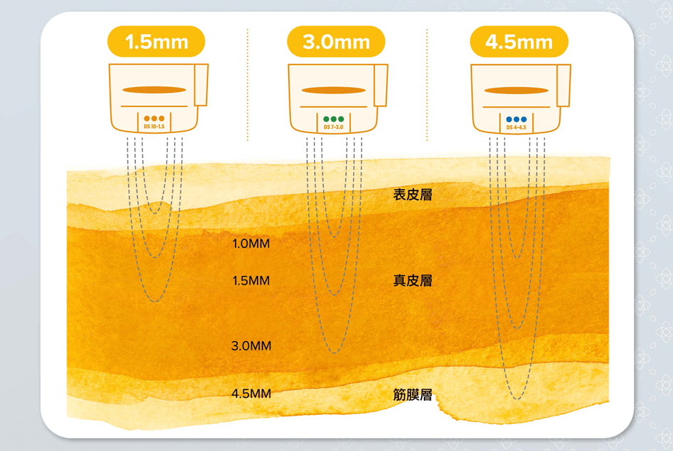 音波拉提原理與不同深度探頭作用範圍
