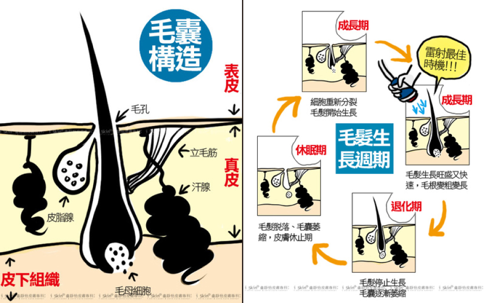 毛髮生長週期與雷射除毛介入時機