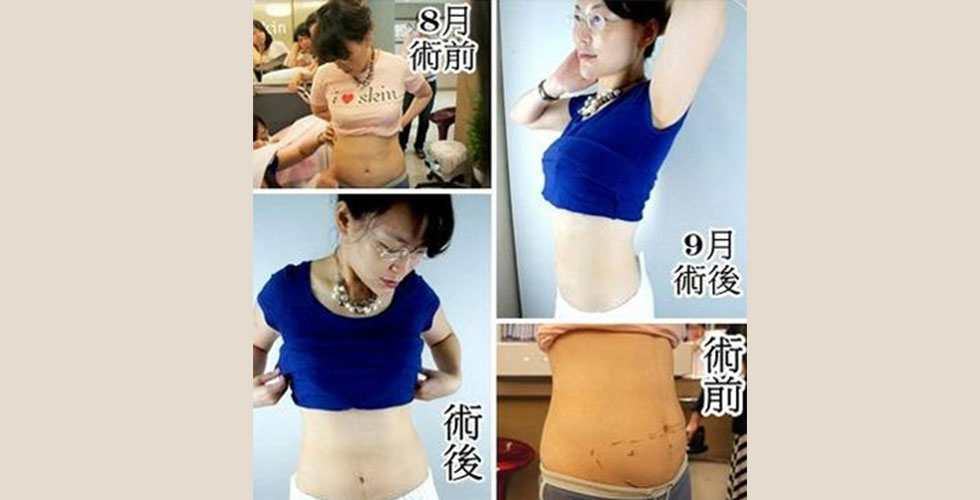 盧醫師治療前後