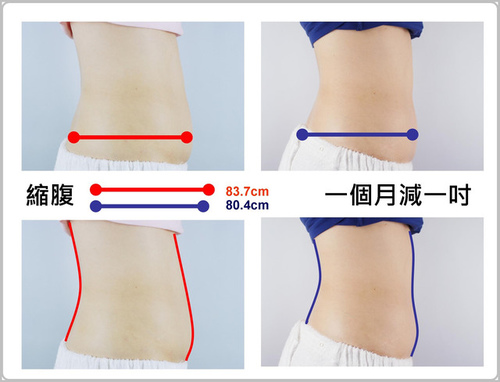 【iSKIN盧靜怡院長親自體驗】生過4個小孩的Dr.盧，再經過2~3次冷凍減脂CoolSculpting療程後，一個月腹圍自83.7cm縮至80.4cm，小腹贅肉凸出縮小了，腹部變平坦了！（效果因個案而異）