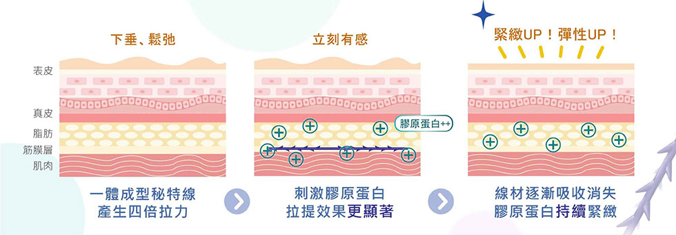 MINT神力拉提，刺激膠原蛋白，維持緊緻、彈性，拉提效果更顯著。