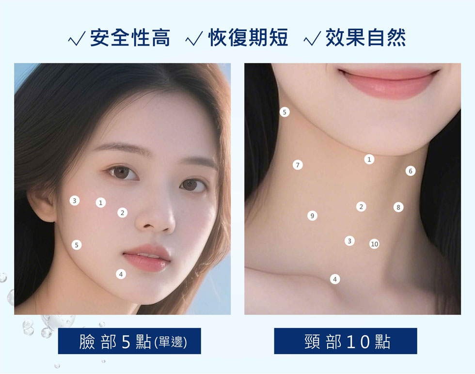 PROFHILO 逆時針專利 BAP（生物美學點）注射法。