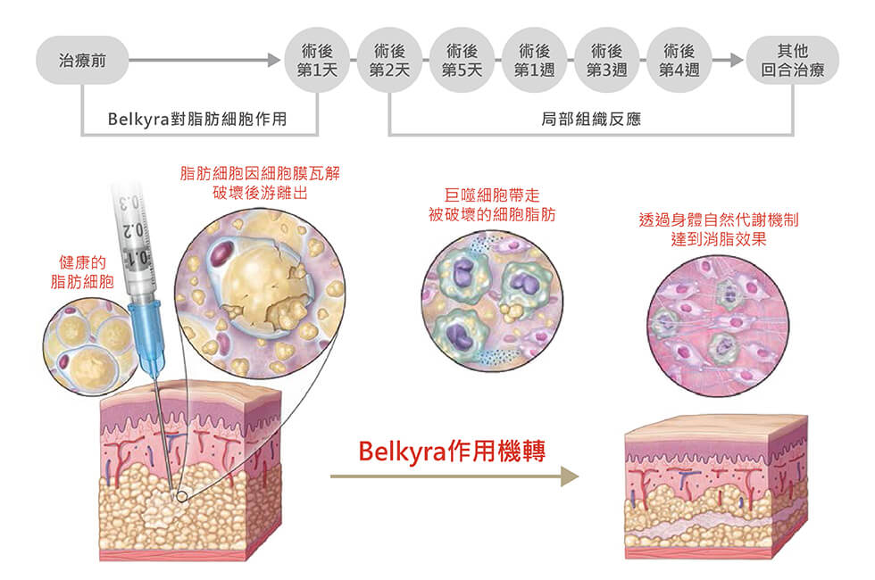 消脂針/倍克脂belkyra作用機轉