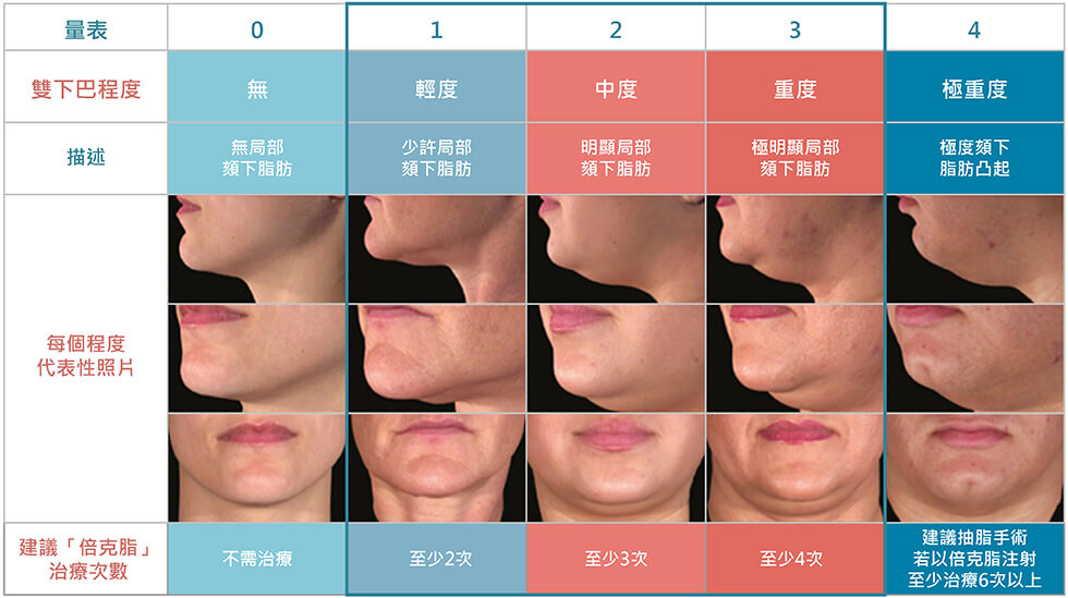 消脂針頦下脂肪分級及建議療程次數