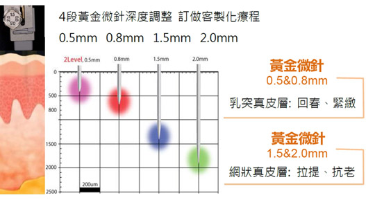 標靶探頭利用可4段式伸縮的黃金微針控制治療深度，使能量準確傳遞到治療區域。