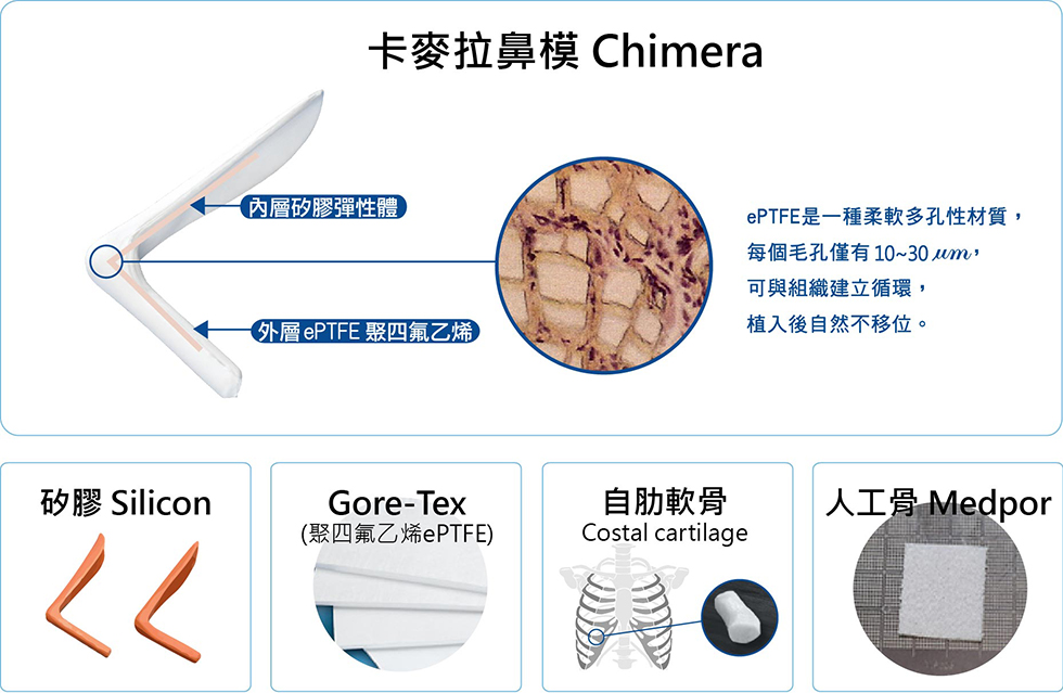 鼻整型 結構式隆鼻 韓式隆鼻 視個人五官塑造出最適合鼻形 Iskin尚行美健康聯合診所 鼻整型 結構式隆鼻 韓式隆鼻 視個人五官塑造出最適合鼻形 Iskin尚行美健康聯合診所