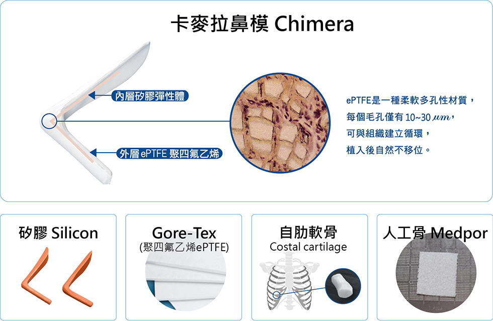 鼻整形素材（下圖由左至右）：矽膠 Silicon、Gore-Tex、自肋軟骨 Costal cartilage、人工骨Medpor。▲卡麥拉鼻模(上圖)外層為Gore-Tex，內層則是矽膠，可以同時保有兩者的優點。