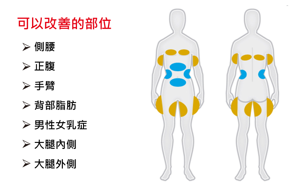 上面為新一代冷凍減脂/美國酷塑目前可以改善的部位