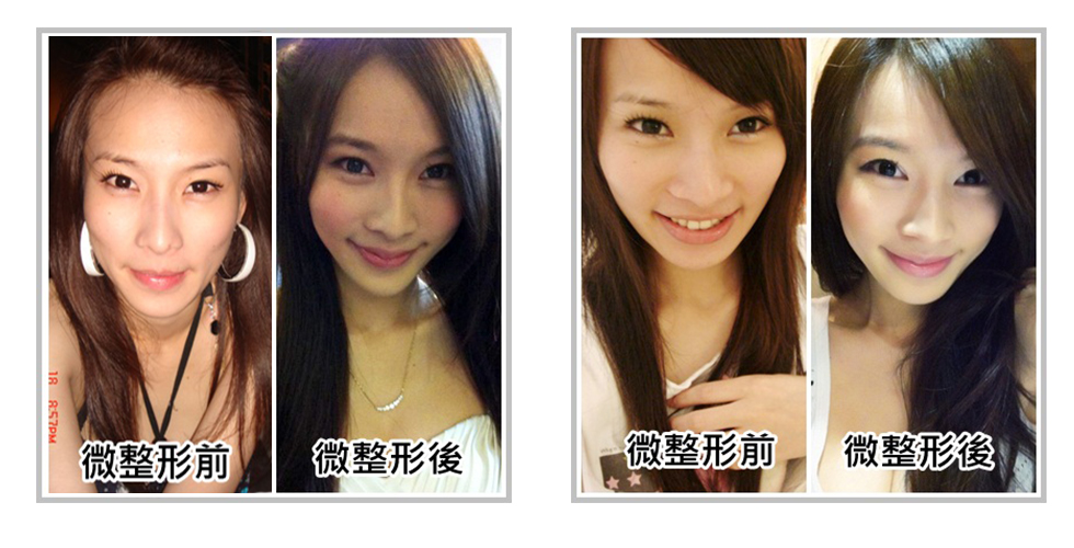 Patty友情限定 iSkin的獨家照片,豪氣公開沒有微整形前的清澀模樣
