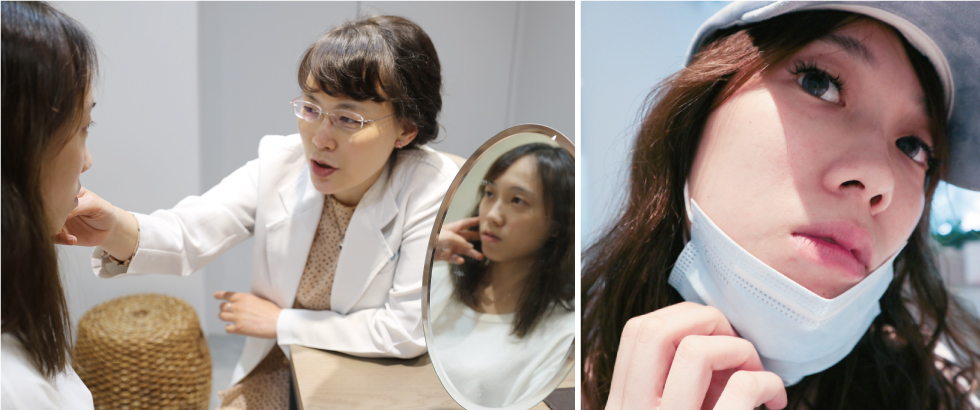 盧靜怡醫師推薦以音波拉提方式,改善我萬惡的嘴角法令紋(口罩內)與拉提下顎輪廓線。