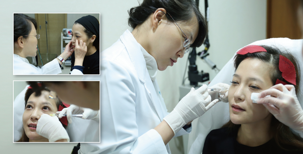 其實打玻尿酸一點都不痛,眼下淚溝、蘋果肌以及中頰拉提,最後美美的成果請看下一張。
