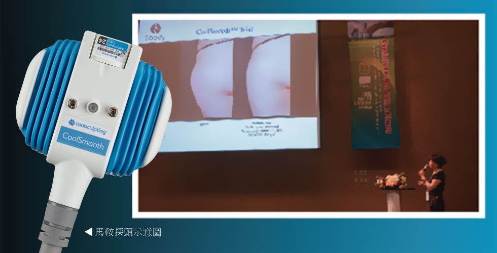 貼合大腿外側的馬鞍探頭,讓療程更有效果。