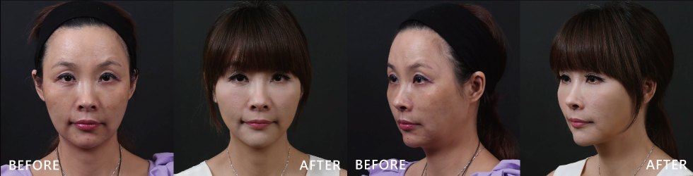 兩百分女人……我，輕鬆蛻變！
