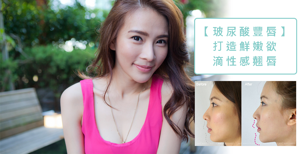 【盧靜怡院長】如何擁有當美女必備的「水嫩ㄉㄨㄞ唇」？