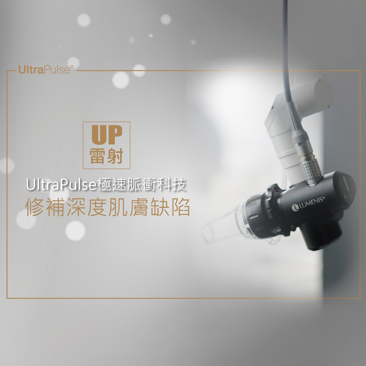 UltraPulse雷射（UP雷射）