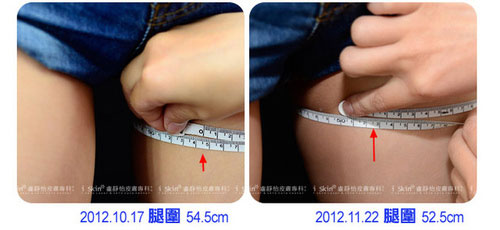左圖治療前腿部54.5cm,一個月後已經變成52.5cm!