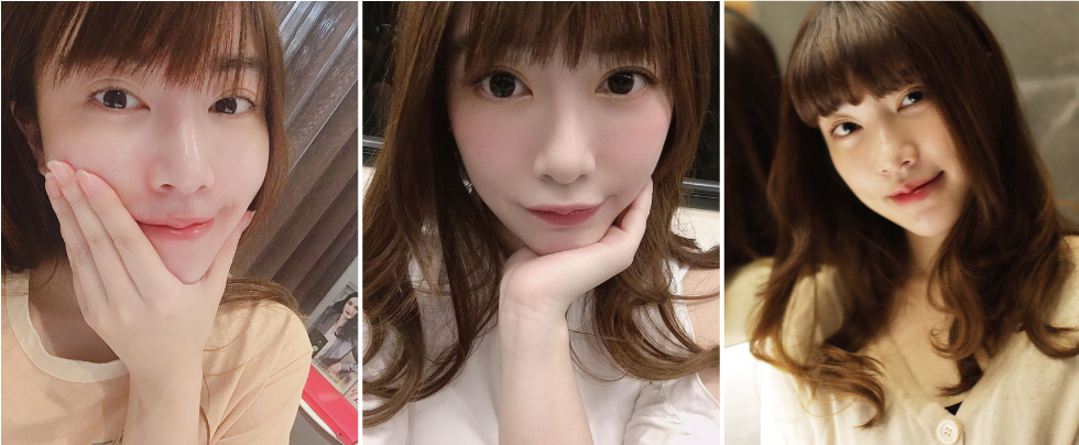 「亮起來!」雖然我的膚色比起一般人算是白皙,術後像是打了光似的「無色差亮白」,有沒有很羨慕呢?!大讚皮秒雷射!
