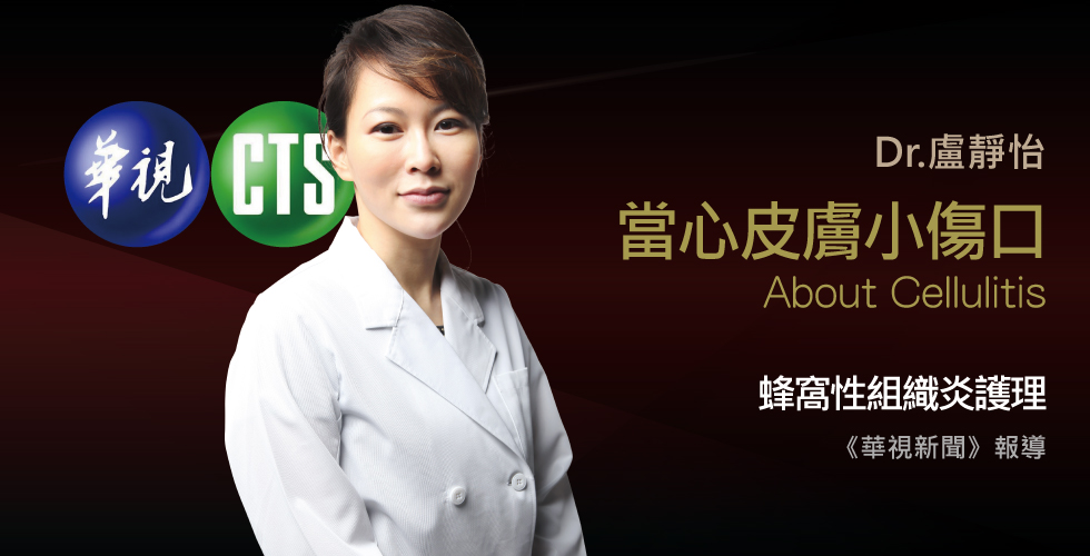 盧靜怡院長受邀《華視新聞》章魚咬傷網紅拇指 逾月未復原