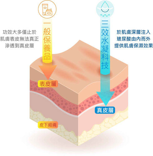 為什麼擦頂級保濕霜還是乾？保養品與聚光針的關鍵差異